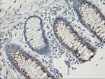 SNAP25 Antibody in Immunohistochemistry (Paraffin) (IHC (P))