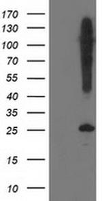 SNAP25 Antibody in Western Blot (WB)