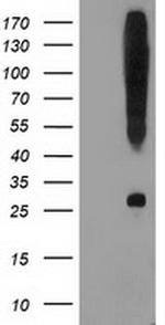 SNAP25 Antibody in Western Blot (WB)
