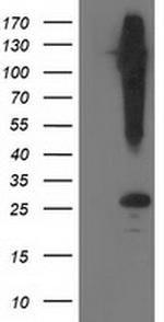 SNAP25 Antibody in Western Blot (WB)