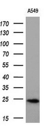 SNAP25 Antibody in Western Blot (WB)