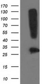 SNAP25 Antibody in Western Blot (WB)