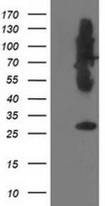 SNAP25 Antibody in Western Blot (WB)