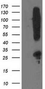SNAP25 Antibody in Western Blot (WB)