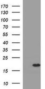 SNCA Antibody in Western Blot (WB)