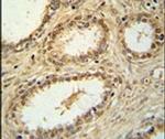 SNRNP40 Antibody in Immunohistochemistry (IHC)