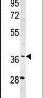 SNRNP40 Antibody in Western Blot (WB)
