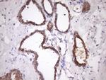 SNRPB2 Antibody in Immunohistochemistry (Paraffin) (IHC (P))