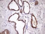 SNRPB2 Antibody in Immunohistochemistry (Paraffin) (IHC (P))
