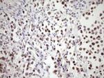 SNRPB2 Antibody in Immunohistochemistry (Paraffin) (IHC (P))