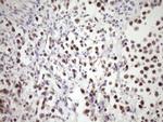 SNRPB2 Antibody in Immunohistochemistry (Paraffin) (IHC (P))