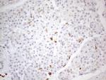 SNRPB2 Antibody in Immunohistochemistry (Paraffin) (IHC (P))