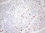 SNRPB2 Antibody in Immunohistochemistry (Paraffin) (IHC (P))