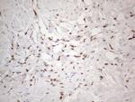 SNRPB2 Antibody in Immunohistochemistry (Paraffin) (IHC (P))