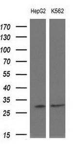 SNRPB2 Antibody in Western Blot (WB)