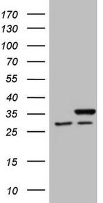SNRPB2 Antibody in Western Blot (WB)