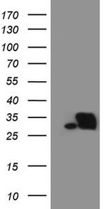 SNRPB2 Antibody in Western Blot (WB)