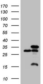 SNRPB2 Antibody in Western Blot (WB)
