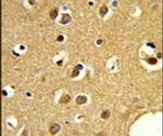 SNRPC Antibody in Immunohistochemistry (IHC)