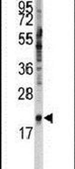 SNRPC Antibody in Western Blot (WB)