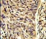 SNRPD1 Antibody in Immunohistochemistry (IHC)