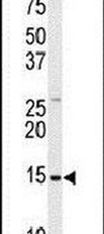 SNRPD1 Antibody in Western Blot (WB)