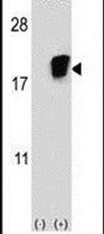 SNRPD1 Antibody in Western Blot (WB)