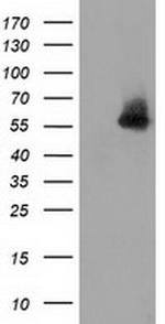 SNTA1 Antibody in Western Blot (WB)