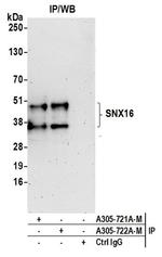 SNX16 Antibody in Western Blot (WB)