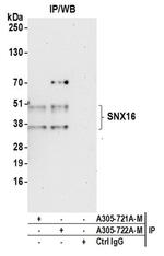 SNX16 Polyclonal Antibody
