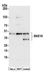 SNX16 Polyclonal Antibody