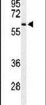 SNX27 Antibody in Western Blot (WB)
