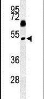 SNX31 Antibody in Western Blot (WB)