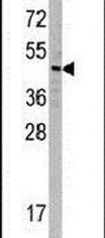 SNX6 Antibody in Western Blot (WB)