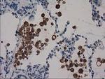 SNX8 Antibody in Immunohistochemistry (Paraffin) (IHC (P))