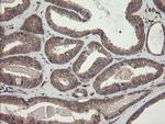 SNX8 Antibody in Immunohistochemistry (Paraffin) (IHC (P))