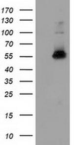 SNX8 Antibody in Western Blot (WB)