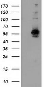 SNX8 Antibody in Western Blot (WB)