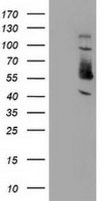 SNX8 Antibody in Western Blot (WB)