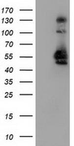 SNX8 Antibody in Western Blot (WB)