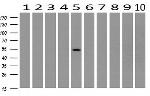 SNX8 Antibody in Western Blot (WB)