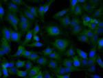 SNX9 Antibody in Immunocytochemistry (ICC/IF)
