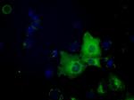 SNX9 Antibody in Immunocytochemistry (ICC/IF)