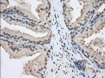 SNX9 Antibody in Immunohistochemistry (Paraffin) (IHC (P))