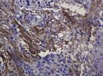 SOAT2 Antibody in Immunohistochemistry (Paraffin) (IHC (P))