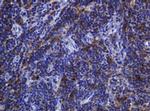 SOAT2 Antibody in Immunohistochemistry (Paraffin) (IHC (P))