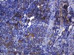 SOAT2 Antibody in Immunohistochemistry (Paraffin) (IHC (P))