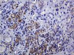 SOAT2 Antibody in Immunohistochemistry (Paraffin) (IHC (P))