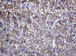 SOAT2 Antibody in Immunohistochemistry (Paraffin) (IHC (P))