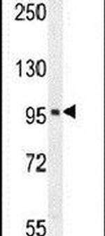SOBP Antibody in Western Blot (WB)